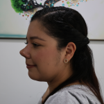Antes y después de una rinoplastia ultrasónica realizada por la Dra. Katherine Hernández. Observa los resultados naturales y armónicos que transforman la apariencia del paciente mientras garantizan un proceso mínimamente invasivo y con una recuperación rápida.